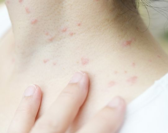 首を刺される夢 首を刺される夢